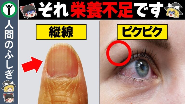 「あなたに足りない栄養素は○○です」栄養不足を知らせる危険なサイン7選【ゆっくり解説】