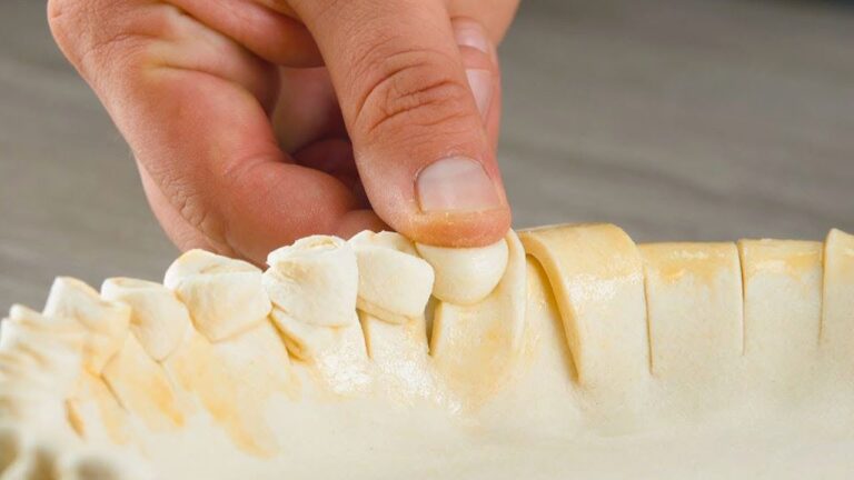 丸めた生地を指で押しつぶすアップルの縦ミルフィーユのようなケーキ