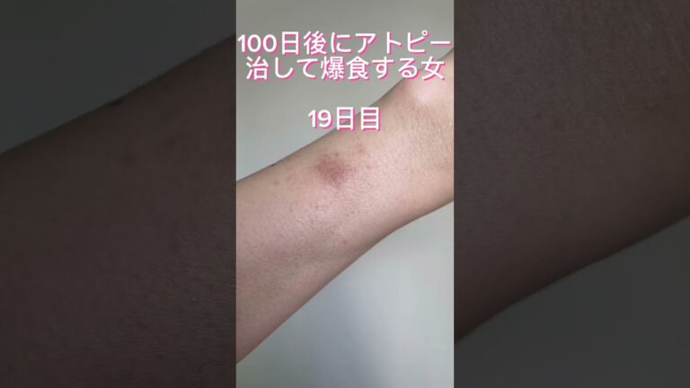 食養生は、さつまいもNGで里芋OKなので準備食は里芋活躍。#アトピー