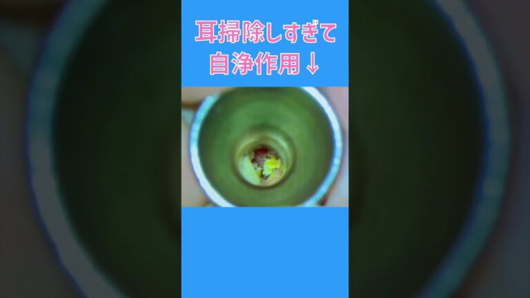 耳そうじ　やりすぎの末路   #shorts  #耳垢 #耳掃除