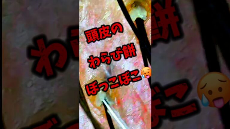 えぇ！？頭皮のわらび餅をクレンジングする理由を解説#shorts