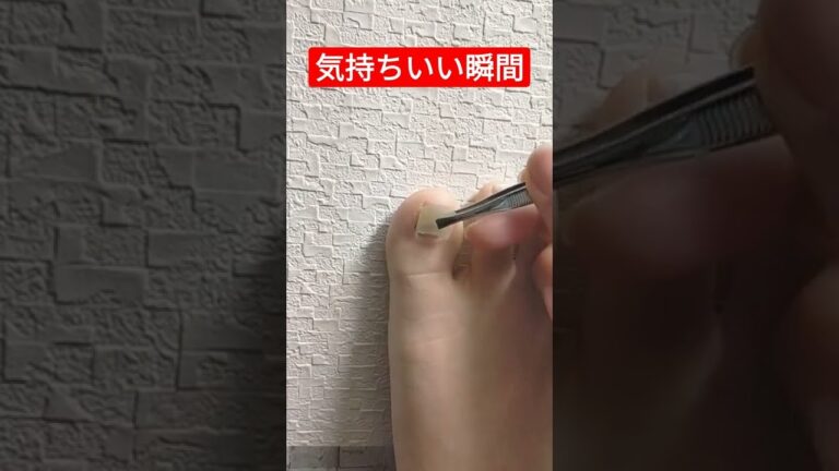 【スッキリ】親指の爪が剥がれ落ちました #shorts  #スッキリ #爪