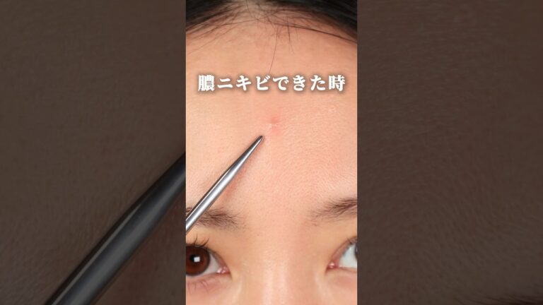 【膿ニキビを数日で枯らす方法！】 #ニキビ #ニキビケア #ニキビケア対策 #ニキビ肌