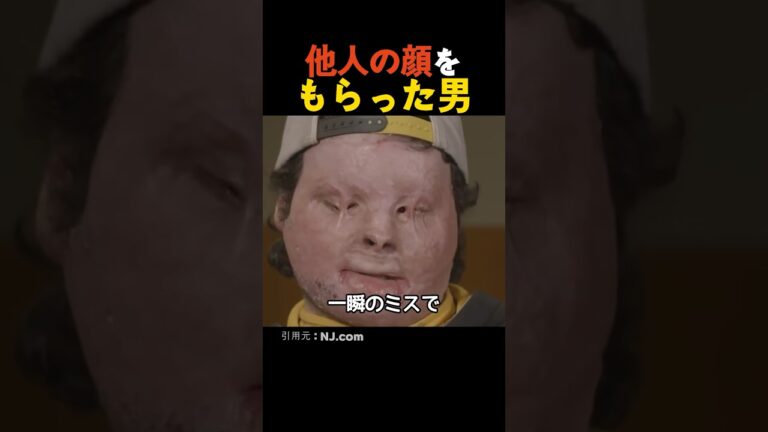 他人の顔で生きる男性