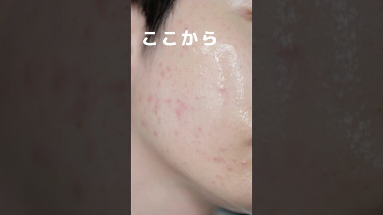3日で肌荒れから美肌に戻した方法。