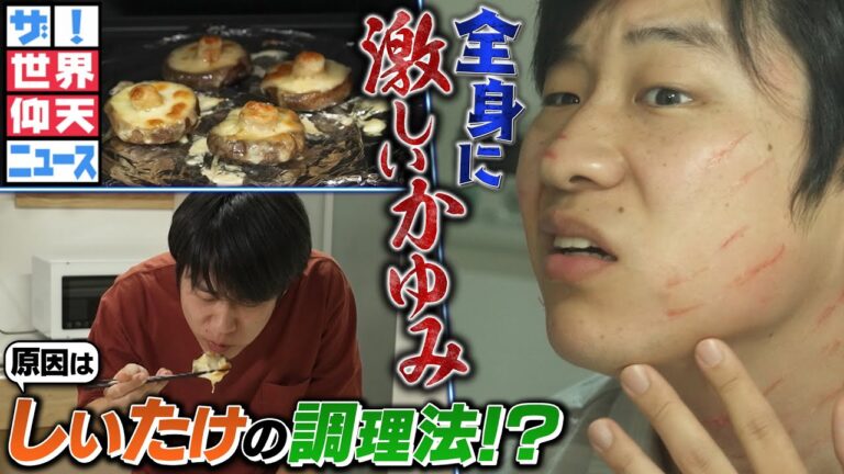 しいたけの美味しい食べ方を真似て全身にムチで打たれたような発疹が！【ザ！世界仰天ニュース】